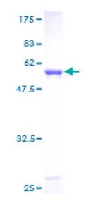 SDS-PAGE (MTAP-5684H).jpg